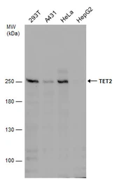 Anti-TET2 antibody [GT649] used in Western Blot (WB). GTX629881