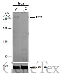 Anti-TET2 antibody [GT649] used in Western Blot (WB). GTX629881