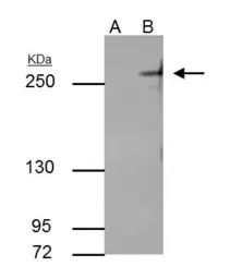 Anti-TET2 antibody [GT649] used in Immunoprecipitation (IP). GTX629881