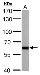 Anti-PUF60 antibody [GT677] used in Western Blot (WB). GTX629886