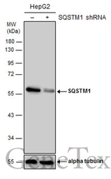 Anti-SQSTM1 / P62 antibody [GT239] used in Western Blot (WB). GTX629888