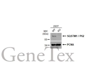 Anti-SQSTM1 / P62 antibody [GT239] used in Western Blot (WB). GTX629888