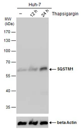 Anti-SQSTM1 / P62 antibody [GT381] used in Western Blot (WB). GTX629889