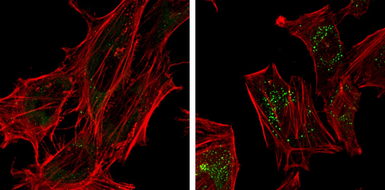 Anti-SQSTM1 / P62 antibody [GT381] used in Immunocytochemistry/ Immunofluorescence (ICC/IF). GTX629889