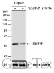 Anti-SQSTM1 / P62 antibody [GT381] used in Western Blot (WB). GTX629889