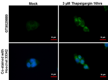 Anti-SQSTM1 / P62 antibody [GT381] used in Immunocytochemistry/ Immunofluorescence (ICC/IF). GTX629889