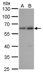 Anti-SQSTM1 / P62 antibody [GT381] used in Western Blot (WB). GTX629889