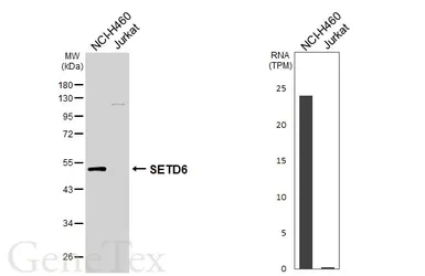 Anti-SETD6 antibody [GT688] used in Western Blot (WB). GTX629891