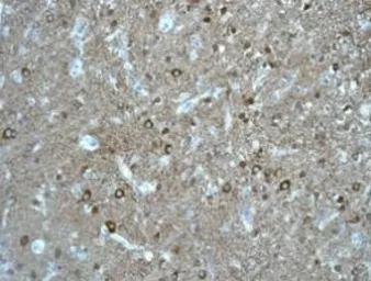 Anti-p39 antibody [EPR5074] used in IHC (Paraffin sections) (IHC-P). GTX62997