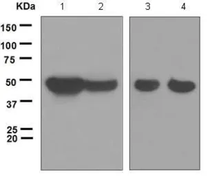 Anti-p39 antibody [EPR5074] used in Western Blot (WB). GTX62997