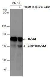 Anti-ROCK1 + ROCK2 antibody [GT464] used in Western Blot (WB). GTX629972