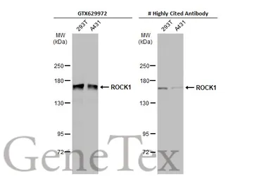 Anti-ROCK1 + ROCK2 antibody [GT464] used in Western Blot (WB). GTX629972