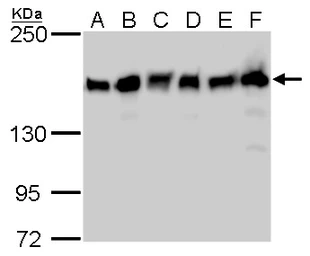 Anti-ROCK1 + ROCK2 antibody [GT464] used in Western Blot (WB). GTX629972