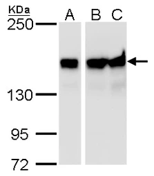 Anti-ROCK1 + ROCK2 antibody [GT464] used in Western Blot (WB). GTX629972