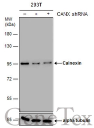 Anti-Calnexin antibody [GT1563] used in Western Blot (WB). GTX629976