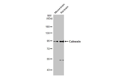 Anti-Calnexin antibody [GT1563] used in Western Blot (WB). GTX629976