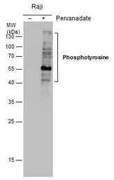 Anti-Phosphotyrosine antibody [GT0021] used in Western Blot (WB). GTX630143
