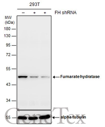 Anti-Fumarate hydratase antibody [GT548] used in Western Blot (WB). GTX630145