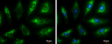 Anti-Fumarate hydratase antibody [GT7612] used in Immunocytochemistry/ Immunofluorescence (ICC/IF). GTX630146