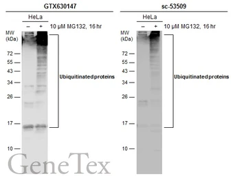 Anti-Ubiquitin antibody [GT751] used in Western Blot (WB). GTX630147