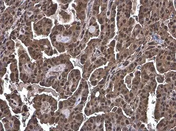 Anti-Ubiquitin antibody [GT751] used in IHC (Paraffin sections) (IHC-P). GTX630147