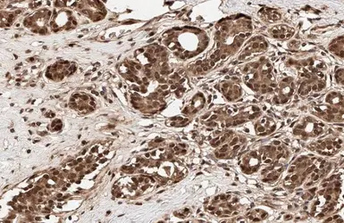 Anti-Ubiquitin antibody [GT751] used in IHC (Paraffin sections) (IHC-P). GTX630147