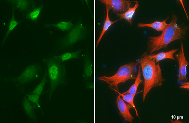 Anti-Ubiquitin antibody [GT751] used in Immunocytochemistry/ Immunofluorescence (ICC/IF). GTX630147