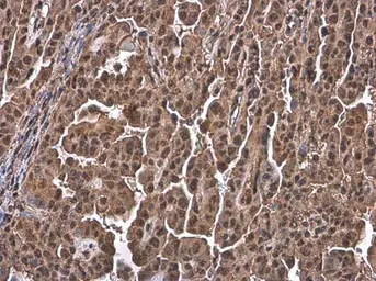 Anti-Ubiquitin antibody [GT7811] used in IHC (Paraffin sections) (IHC-P). GTX630148
