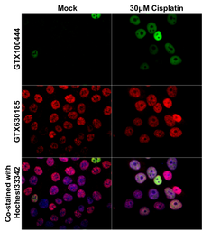 Anti-Histone H3S10ph (phospho Ser10) antibody [GT921] used in Immunocytochemistry/ Immunofluorescence (ICC/IF). GTX630185