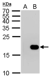 Anti-Histone H3S10ph (phospho Ser10) antibody [GT921] used in Western Blot (WB). GTX630185