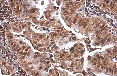 Anti-PRMT1 antibody [GT779] used in IHC (Paraffin sections) (IHC-P). GTX630186