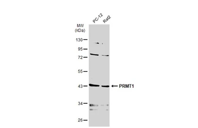 Anti-PRMT1 antibody [GT779] used in Western Blot (WB). GTX630186