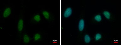 Anti-PRMT1 antibody [GT779] used in Immunocytochemistry/ Immunofluorescence (ICC/IF). GTX630186