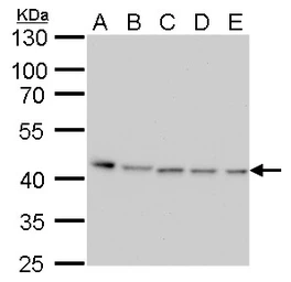 Anti-PRMT1 antibody [GT779] used in Western Blot (WB). GTX630186