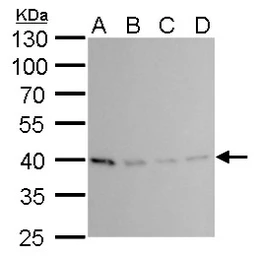 Anti-PRMT1 antibody [GT779] used in Western Blot (WB). GTX630186