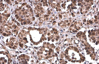 Anti-PRMT1 antibody [GT10111] used in IHC (Paraffin sections) (IHC-P). GTX630187
