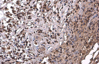Anti-PRMT1 antibody [GT10111] used in IHC (Paraffin sections) (IHC-P). GTX630187