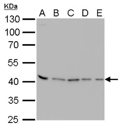 Anti-PRMT1 antibody [GT10111] used in Western Blot (WB). GTX630187