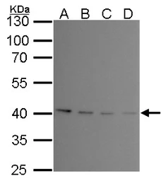 Anti-PRMT1 antibody [GT10111] used in Western Blot (WB). GTX630187