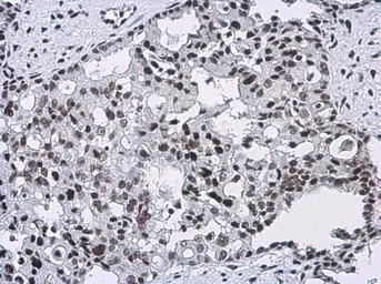 Anti-CFDP1 antibody [GT11811] used in IHC (Paraffin sections) (IHC-P). GTX630190