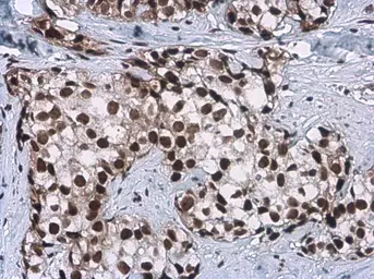 Anti-CFDP1 antibody [GT11811] used in IHC (Paraffin sections) (IHC-P). GTX630190