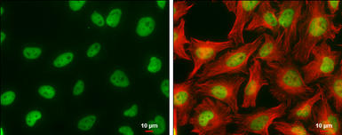 Anti-CFDP1 antibody [GT11811] used in Immunocytochemistry/ Immunofluorescence (ICC/IF). GTX630190