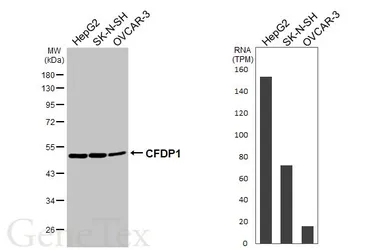 Anti-CFDP1 antibody [GT11811] used in Western Blot (WB). GTX630190