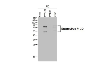 Anti-Enterovirus 71 3D antibody [4] used in Western Blot (WB). GTX630193