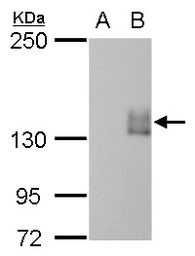 Anti-mCherry antibody [GT844] used in Western Blot (WB). GTX630195