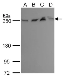 Anti-mTOR antibody [GT649] used in Western Blot (WB). GTX630198