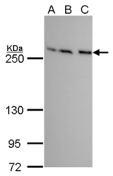 Anti-mTOR antibody [GT649] used in Western Blot (WB). GTX630198