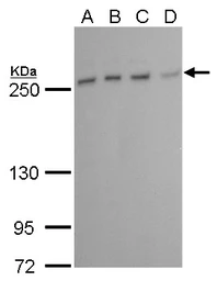 Anti-mTOR antibody [GT778] used in Western Blot (WB). GTX630200