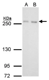 Anti-mTOR antibody [GT778] used in Western Blot (WB). GTX630200