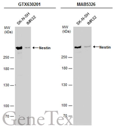 Anti-Nestin antibody [GT623] used in Western Blot (WB). GTX630201